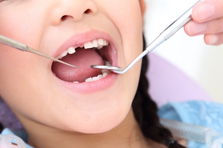 乳歯の歯並びが悪い原因は？