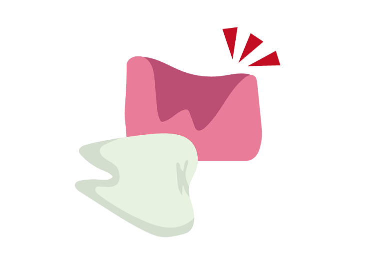 歯が抜けた場合
