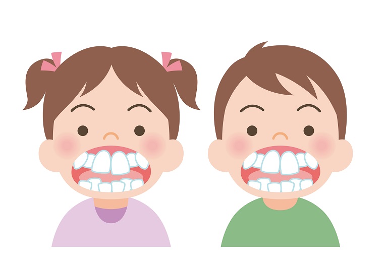 歯並びが悪いと言われた…