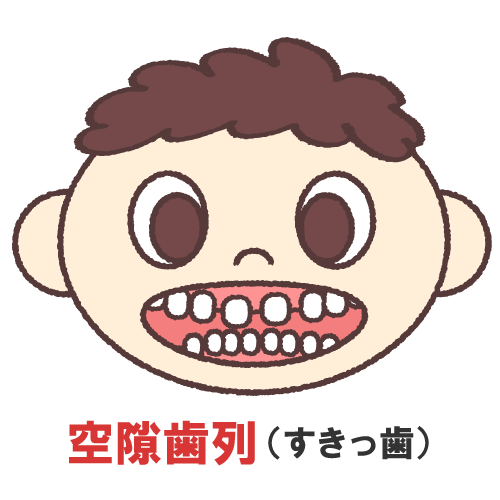 出っ歯・すきっ歯・前歯のすき間でお悩みの方へ