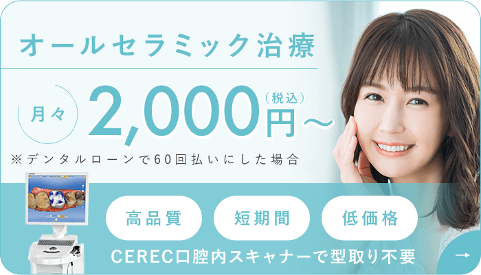 オールセラミック治療 月々2,000円（税込）（60回払いの場合、分割手数料が必要）高品質・短期間・低価格　CEREC口腔内スキャナーで型取り不要