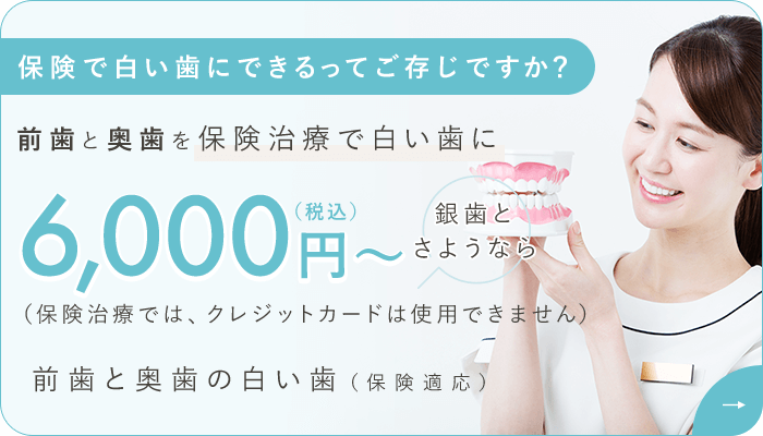 保険で白い歯にできるってご存じですか？前歯と奥歯を保険治療で白い歯に 6,000円（税込）～（保険治療では、クレジットカードは使用できません）