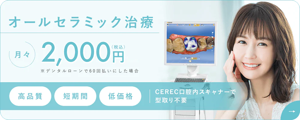 オールセラミック治療 月々2,000円（税込）（60回払いの場合、分割手数料が必要）高品質・短期間・低価格　CEREC口腔内スキャナーで型取り不要