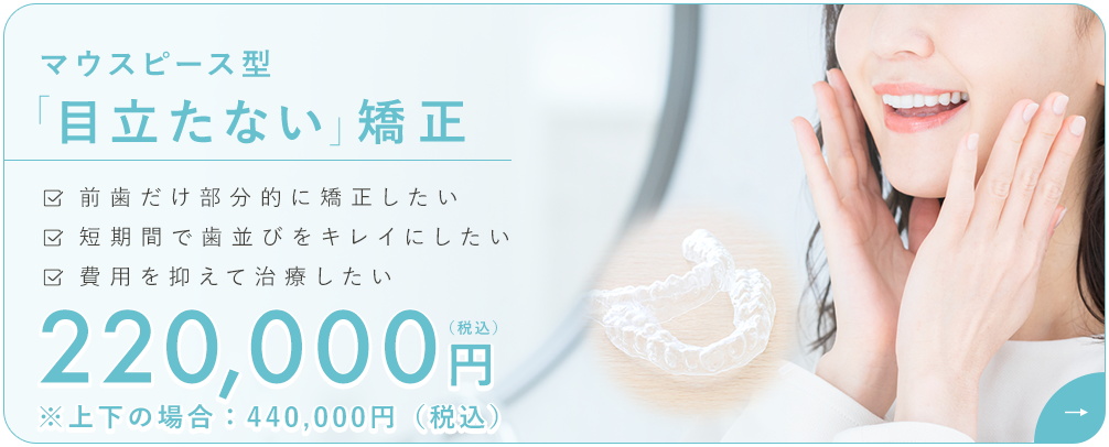マウスピース矯正