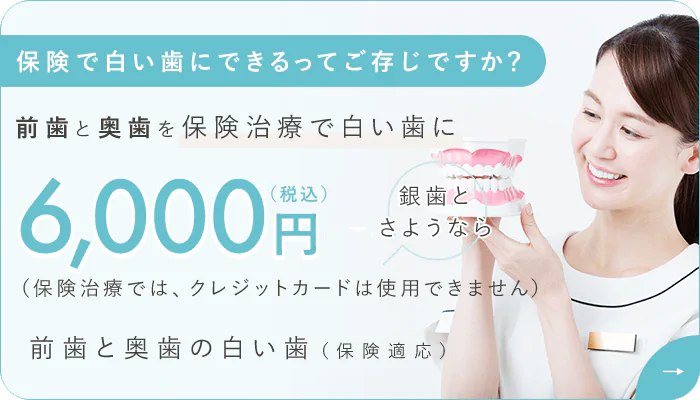 保険で白い歯にできるってご存じですか？前歯と奥歯を保険治療で白い歯に 6,000円（税込）（保険治療では、クレジットカードは使用できません）