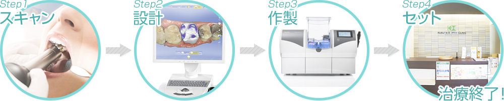 くすべ歯科のセレック治療の流れ