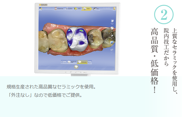 セレック治療6つの安心