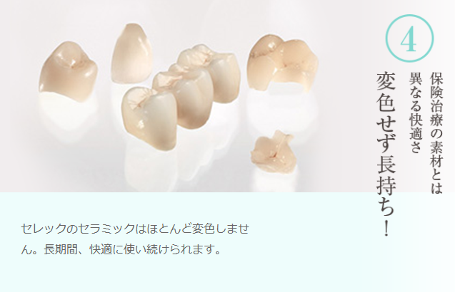 セレック治療6つの安心