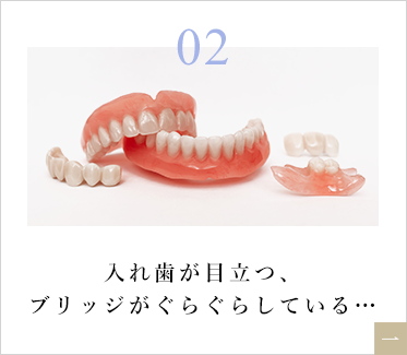 入れ歯が目立つ、ブリッジがぐらぐらしている…