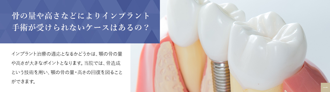 骨の量や高さなどによりインプラント手術が受けられないケースはあるの？