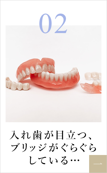 入れ歯が目立つ、ブリッジがぐらぐらしている…