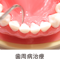 歯周病治療