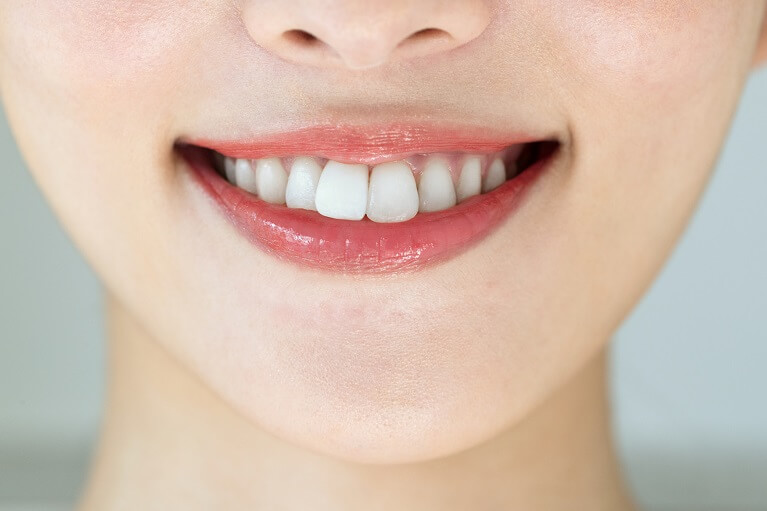 あなたの前歯は「絶対的」に大きい？それとも「相対的」に大きい？