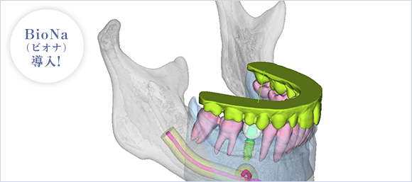 顎顔面の三次元シュミレーションによる正確な治療計画