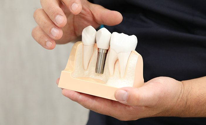 歯科技工士が患者様と直接対応スムーズで質の高い技工物のご提供