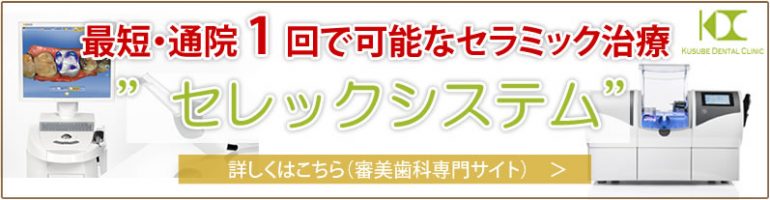 セレックシステム