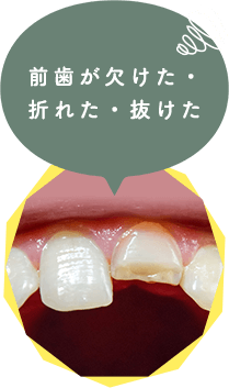 こんな前歯と奥歯のお悩みございませんか？