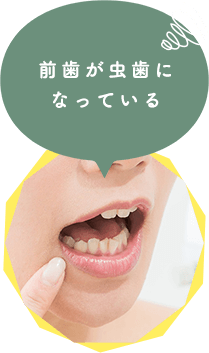 こんな前歯と奥歯のお悩みございませんか？