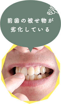 こんな前歯と奥歯のお悩みございませんか？