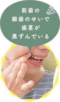 こんな前歯と奥歯のお悩みございませんか？