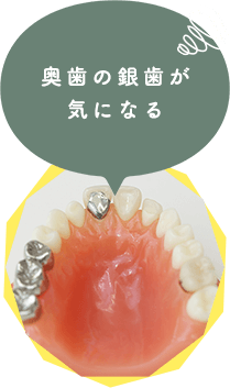 こんな前歯と奥歯のお悩みございませんか？