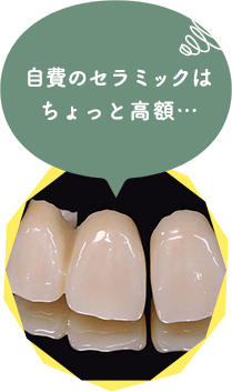 こんな前歯と奥歯のお悩みございませんか？